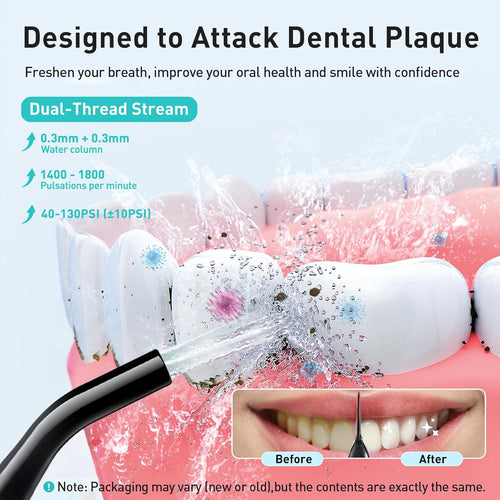 Cordless Water Dental Flosser – 300 ml Rechargeable Oral Irrigator